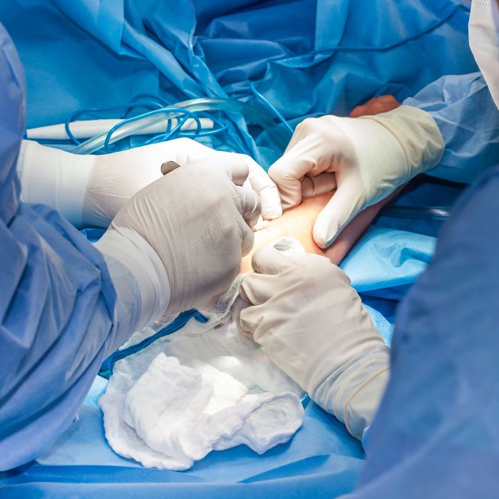 tennis elbow surgery melbourne Tennis Elbow Surgery