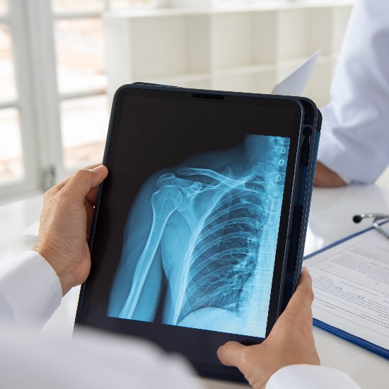 shoulder-x-ray-consult